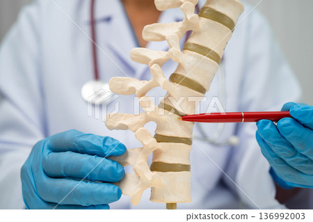 Doctor holding osteoporosis in back bone model for treatment medical in orthopedic department. Doctor holding osteoporosis in back bone model for treatment medical in orthopedic department. 136992003