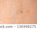 Skin mole spot closeup. Human birthmark, nevus macro texture 136998275