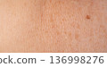 Skin mole spot closeup. Human birthmark, nevus macro texture 136998276
