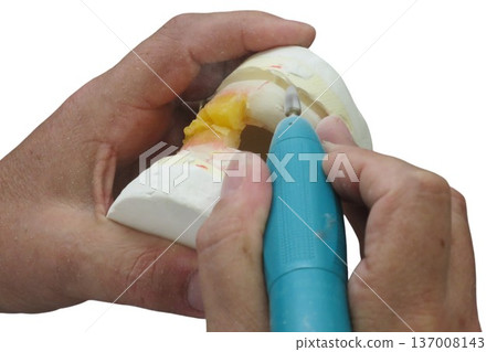 Dental technician grinding prosthesis in a laboratory 137008143