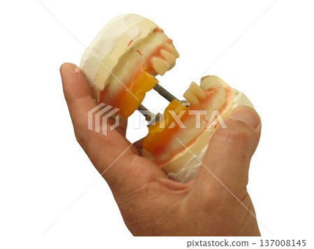 Hand holding dental plaster teeth cast model Hand holding dental plaster teeth cast model 137008145