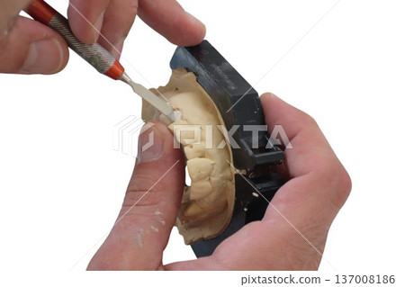Dental technician shaping plaster mold for prosthetic denture Dental technician shaping plaster mold for prosthetic denture 137008186