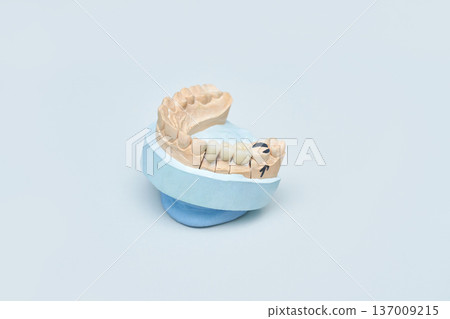 Dental prosthetic model displaying detailed mold of upper teeth on blue base 137009215