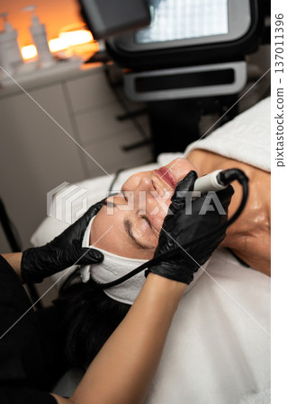 Professional beautician in black gloves applying advanced aesthetic treatment to a woman's face, performing skin rejuvenation 137011396