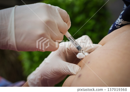 close up doctor is injecting enoxaparin injection to belly with syringe close up doctor is injecting enoxaparin injection to belly with syringe 137019368