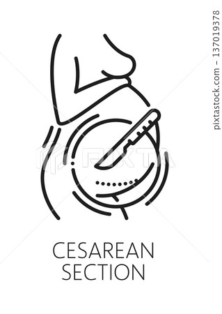 Cesarean section gynecology medical line icon or sign. Pregnancy healthcare outline sign, urinary health and woman fertility vector icon. Reproductive health, gynecology symbol with womb and scalpel Cesarean section gynecology medical line icon or sign. Pregnancy healthcare outline sign, urinary health and woman fertility vector icon. Reproductive health, gynecology symbol with womb and scalpel 137019378