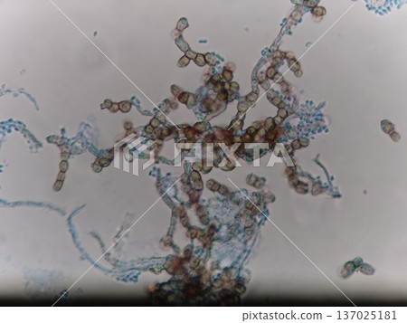 Microscopic photo of black mold on a silicone cover 137025181