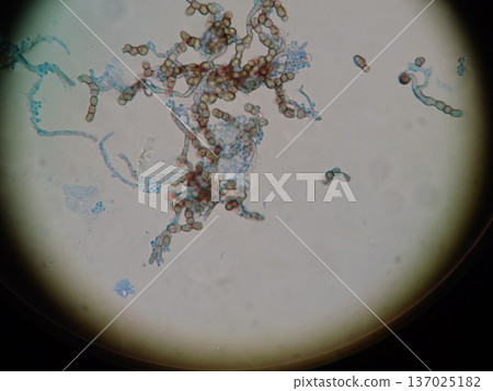 黴菌孢子和菌絲的顯微照片 137025182