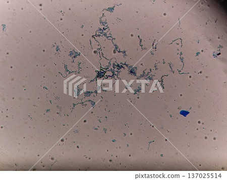 廚房矽膠上長了黑黴 137025514