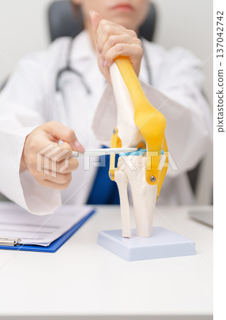 Doctor with Human Knee joint anatomy model. Osteoarthritis, Patellofemoral Pain Syndrome, Patellar Tendinitis, ACL, Anterior Cruciate Ligament, PCL, Posterior, MCL, Medial Collateral, LCL and Lateral 137042742