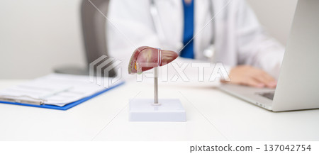 Doctor with human Liver anatomy model. Liver cancer and Tumor, Jaundice, Viral Hepatitis A, B, C, D, E, Cirrhosis, Failure, Enlarged, Hepatic Encephalopathy, Ascites Fluid in Belly and health concept 137042754