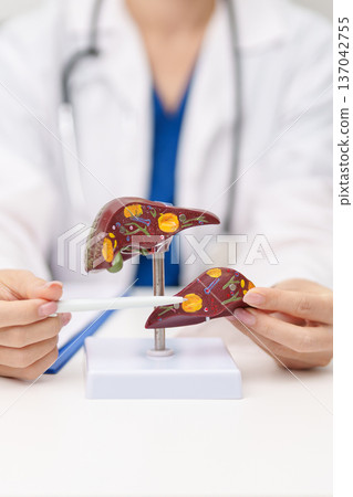 Doctor with human Liver anatomy model. Liver cancer and Tumor, Jaundice, Viral Hepatitis A, B, C, D, E, Cirrhosis, Failure, Enlarged, Hepatic Encephalopathy, Ascites Fluid in Belly and health concept 137042755