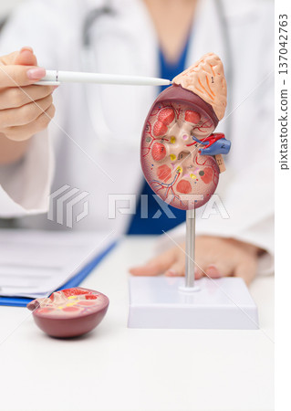 Doctor with Kidney Adrenal gland anatomy model. disease of Urinary system and Stones, Cancer, world kidney day, Chronic kidney, Urology, Nephritis, Renal, Transplant and health concept Doctor with Kidney Adrenal gland anatomy model. disease of Urinary system and Stones, Cancer, world kidney day, Chronic kidney, Urology, Nephritis, Renal, Transplant and health concept 137042763