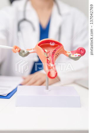 Doctor with Uterus and Ovaries anatomy model. Ovarian and Cervical cancer, Cervix disorder, Endometriosis, Hysterectomy, Uterine fibroids, Reproductive system, Pregnancy and health concept Doctor with Uterus and Ovaries anatomy model. Ovarian and Cervical cancer, Cervix disorder, Endometriosis, Hysterectomy, Uterine fibroids, Reproductive system, Pregnancy and health concept 137042769