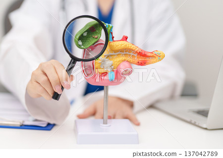 Doctor with human Pancreatitis anatomy model with Pancreas, Gallbladder, Bile Duct, Duodenum, Small intestine. Pancreatic cancer, Acute and Chronic pancreatitis, Digestive system and Health concept 137042789
