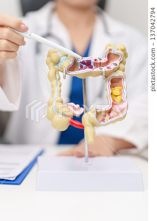 Doctor with human Colon anatomy model. Colonic disease, Large Intestine, Colorectal cancer, Ulcerative colitis, Diverticulitis, Irritable bowel syndrome, Digestive system and Healthcare concept Doctor with human Colon anatomy model. Colonic disease, Large Intestine, Colorectal cancer, Ulcerative colitis, Diverticulitis, Irritable bowel syndrome, Digestive system and Healthcare concept 137042794