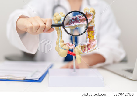 Doctor with human Colon anatomy model. Colonic disease, Large Intestine, Colorectal cancer, Ulcerative colitis, Diverticulitis, Irritable bowel syndrome, Digestive system and Healthcare concept 137042796