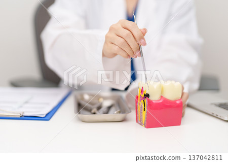 Dentist with tooth Anatomy model. Oral Teeth decay and disease, Scrape off tartar. March Oral health, Dentist Day, False Teeth. Toothache and Children Dental Health Month and Orthodontic Health Day 137042811