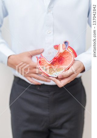Man having abdomen pain or Stomachache with Gastric anatomy model. stomach diseases and ulcers, Gastroesophageal Reflux, November stomach cancer, Gastroenterologist consultation and Acid reflux 137042842