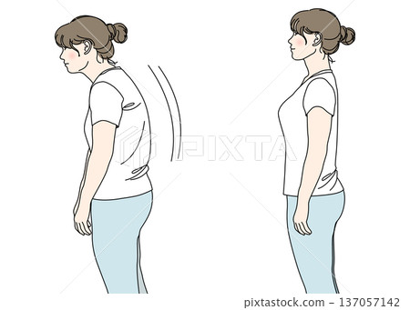 比較插圖:一位駝背的中年女性與一位姿態端正的女性,上半身側向,彩色 比較插圖:一位駝背的中年女性與一位姿態端正的女性,上半身側向,彩色 137057142