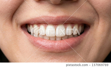 Close-up of whitened beautiful white teeth, cosmetic dentistry, dental care, people Close-up of whitened beautiful white teeth, cosmetic dentistry, dental care, people 137069789