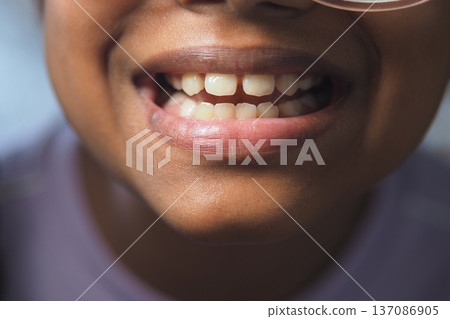 Child smiles widely showing teeth at home 137086905