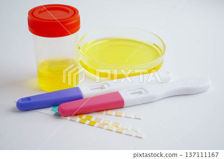 Urinalysis, urine cup with reagent strip pH paper test and comparison chart in laboratory. 137111167