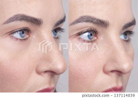 Collage two photo woman one eye with twisted laminated eyelashes, the second eye is regular, without cosmetic procedures. Beautiful blue eyes Collage two photo woman one eye with twisted laminated eyelashes, the second eye is regular, without cosmetic procedures. Beautiful blue eyes 137114839