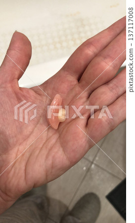 Small removable dental prosthesis resting on human palm in bathroom interior under artificial light. Dentistry treatment, oral health care, prosthetic tooth replacement and dental clinic medical 137117008