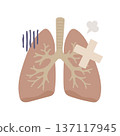 圖示為一個看起來不健康的肺部，上面纏著繃帶。 137117945