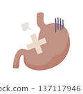 圖示：一個不健康的胃，上面纏著繃帶。 137117946