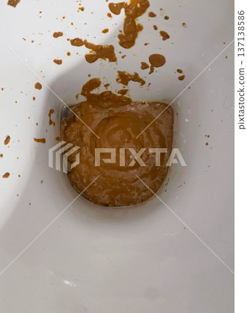 White toilet filled with human excrement 137138586