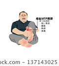 插圖描繪了一位中年男子因痛風發作，大腳趾蹠趾關節出現嚴重的紅腫、發熱和疼痛。 137143025