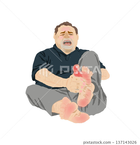 Illustration of a middle-aged man experiencing severe redness, swelling, heat, and pain in the MTP joint of the big toe due to a gout attack 137143026