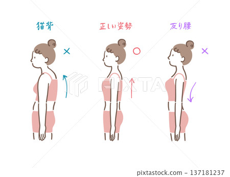 對比插圖，展示了從側面看到的正確姿勢與駝背和拱背女性的姿勢。 137181237