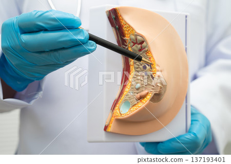 Doctor holding female breast human anatomy model. 137193401