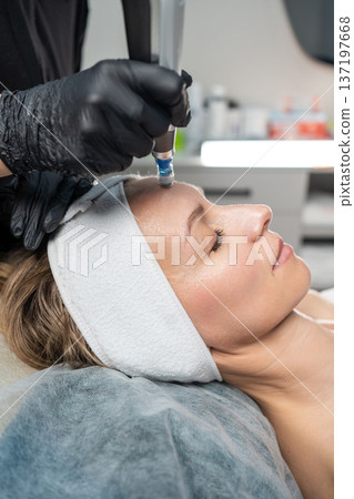 Professional performing microneedling treatment on a woman's forehead in a medical spa 137197668