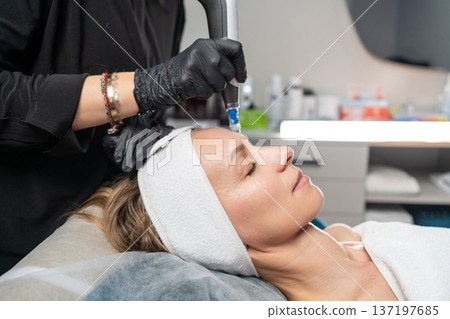 Woman getting microneedling facial treatment in a professional beauty spa Woman getting microneedling facial treatment in a professional beauty spa 137197685