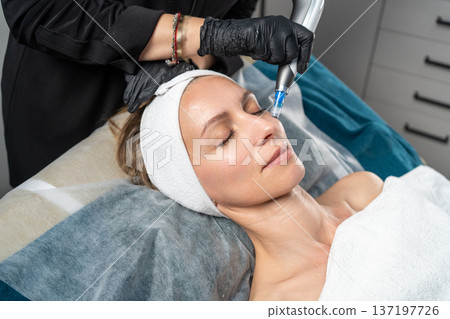 Woman getting microneedling procedure for skin rejuvenation on her face 137197726