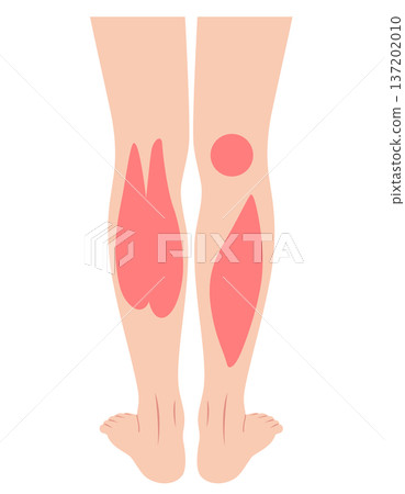 Calf muscles: Gastrocnemius, Soleus, Triceps surae Calf muscles: Gastrocnemius, Soleus, Triceps surae 137202010