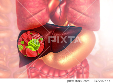 virus infected human liver virus infected human liver 137202563