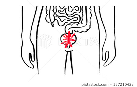 Bladder inflammation pain 137210422