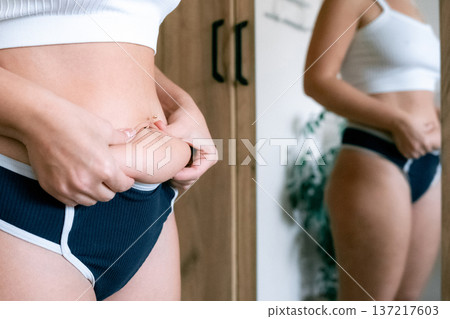 Woman body. Cellulite and fat folds close up. Health awareness c 137217603