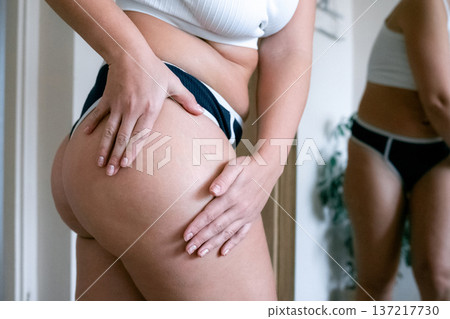 Woman fat problem. Female touching waistline skin close view. Ph Woman fat problem. Female touching waistline skin close view. Ph 137217730