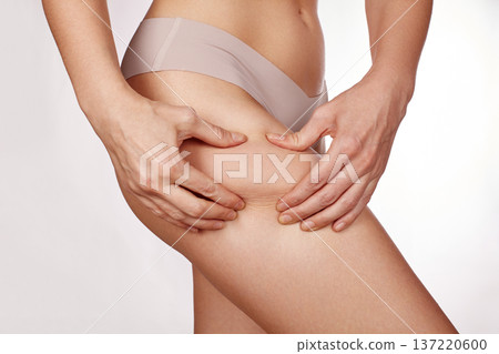 Woman Pinching Thigh Showing Cellulite Closeup Study Of Skin Texture And Dimples, Underwear Visible, Subtle Soft Lighting, Neutral Studio Background, Selfexamination Mood, Cosmetic Concern And Body Woman Pinching Thigh Showing Cellulite Closeup Study Of Skin Texture And Dimples, Underwear Visible, Subtle Soft Lighting, Neutral Studio Background, Selfexamination Mood, Cosmetic Concern And Body 137220600