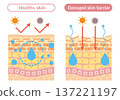 A cross-sectional illustration of the skin explaining the difference between normal and impaired skin barrier function 137221197