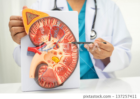 Chronic kidney disease, doctor with model for treatment urinary system, urology, Estimated glomerular filtration rate eGFR. Chronic kidney disease, doctor with model for treatment urinary system, urology, Estimated glomerular filtration rate eGFR. 137257411