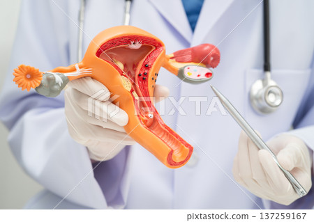 Uterus, doctor holding human anatomy model for study diagnosis and treatment in hospital. Uterus, doctor holding human anatomy model for study diagnosis and treatment in hospital. 137259167