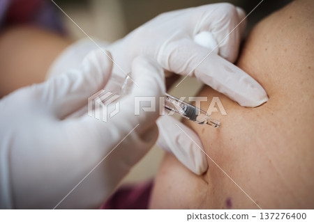 close up doctor is injecting enoxaparin injection to belly with syringe close up doctor is injecting enoxaparin injection to belly with syringe 137276400