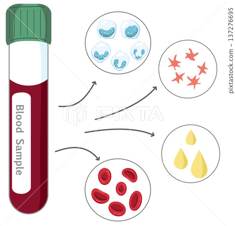Blood Sample Analysis - Blood Tube with Red and White Blood Cells, Platelets, and Plasma 137276695